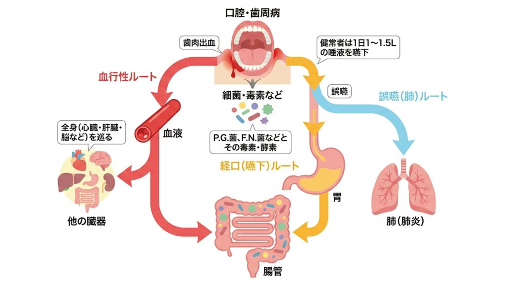 口腔内の歯周病（P.G.菌、F.N.菌などとその毒素・酵素）から全身へ至る3つの侵入ルートを示した解説図。左の「血行性ルート（赤）」は歯肉出血から血液を介して全身の他の臓器や腸管へ巡る経路、中央の「経口（嚥下）ルート（黄）」は1日1〜1.5Lの唾液の嚥下により胃を経て腸管へ至る経路、右の「誤嚥（肺）ルート（青）」は誤嚥によって肺（肺炎）へ至る経路として描かれています。
