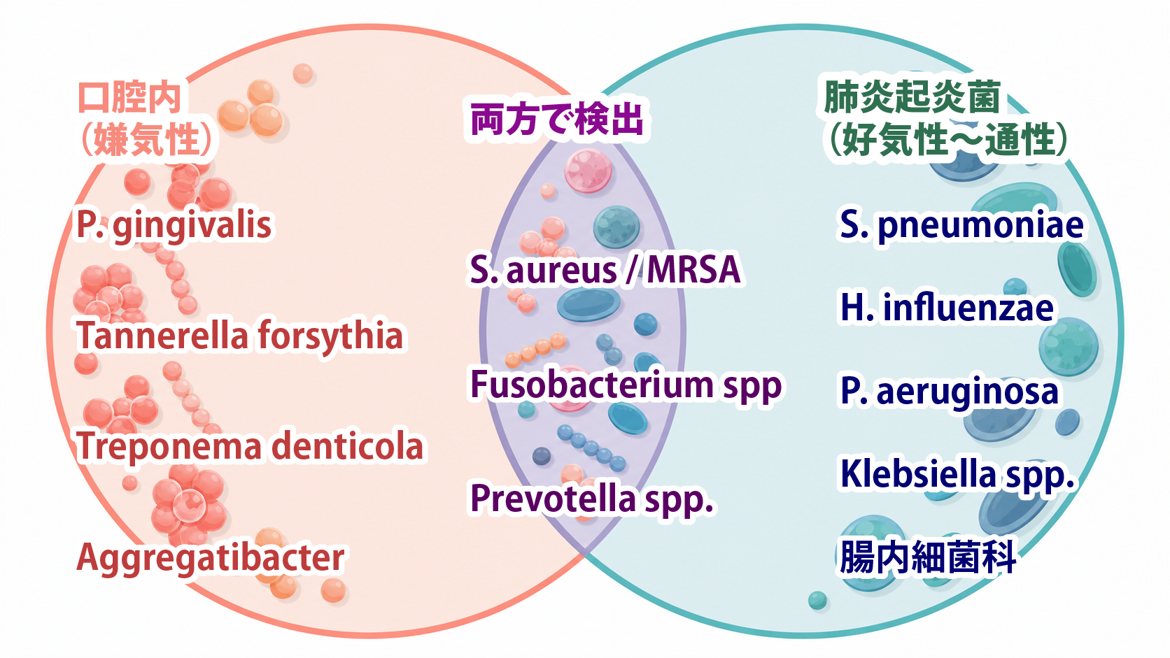 口腔内細菌と誤嚥性肺炎の起炎菌の重なりを示すベン図。口腔内の嫌気性菌、肺炎の好気性起炎菌、両方で検出される菌を対比
