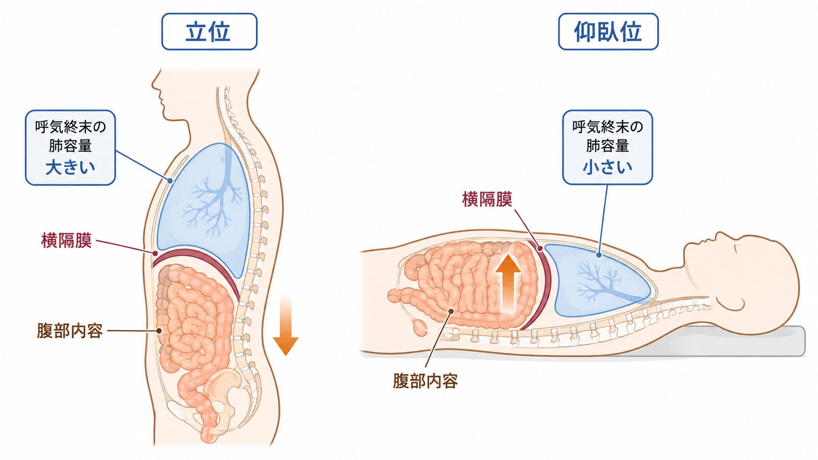 立位と仰臥位における横隔膜位置と呼気終末肺容量の違いを示す模式図