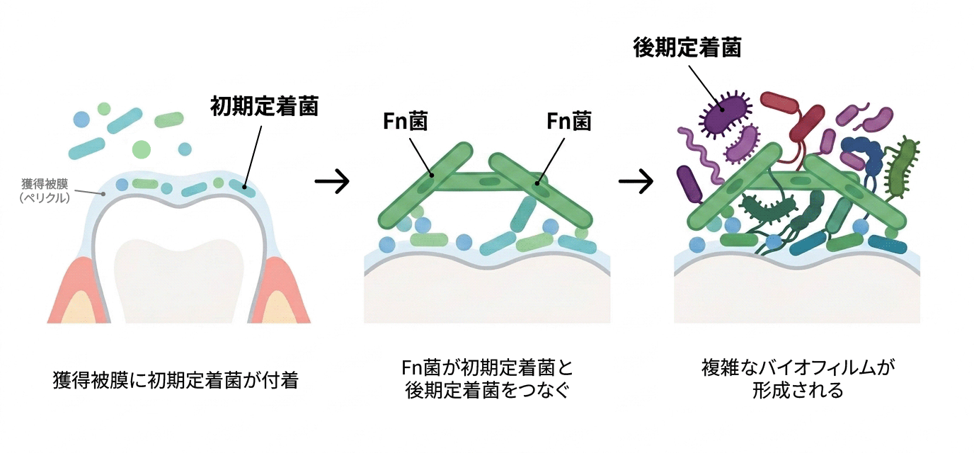 歯面の初期定着菌と後期定着菌をFn菌がつなぎ、複雑なバイオフィルムが形成される模式図